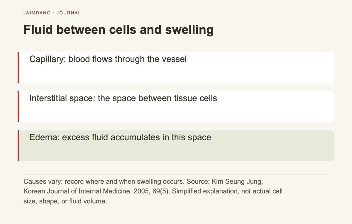 Diagram explaining edema mechanism: fluid accumulation outside capillaries in tissue spaces